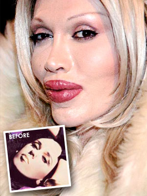 Plastic Surgery Woman